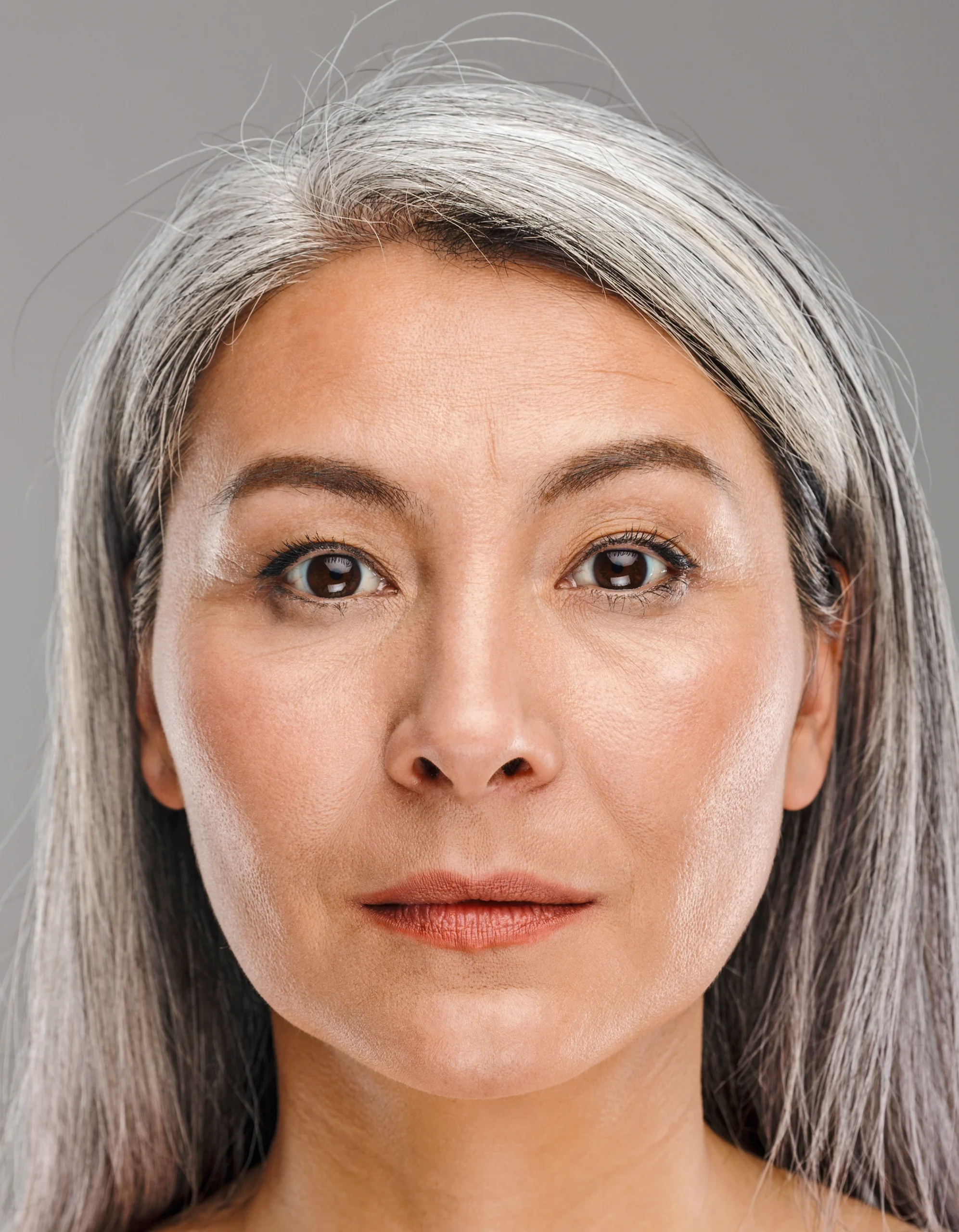 asian blepharoplasty