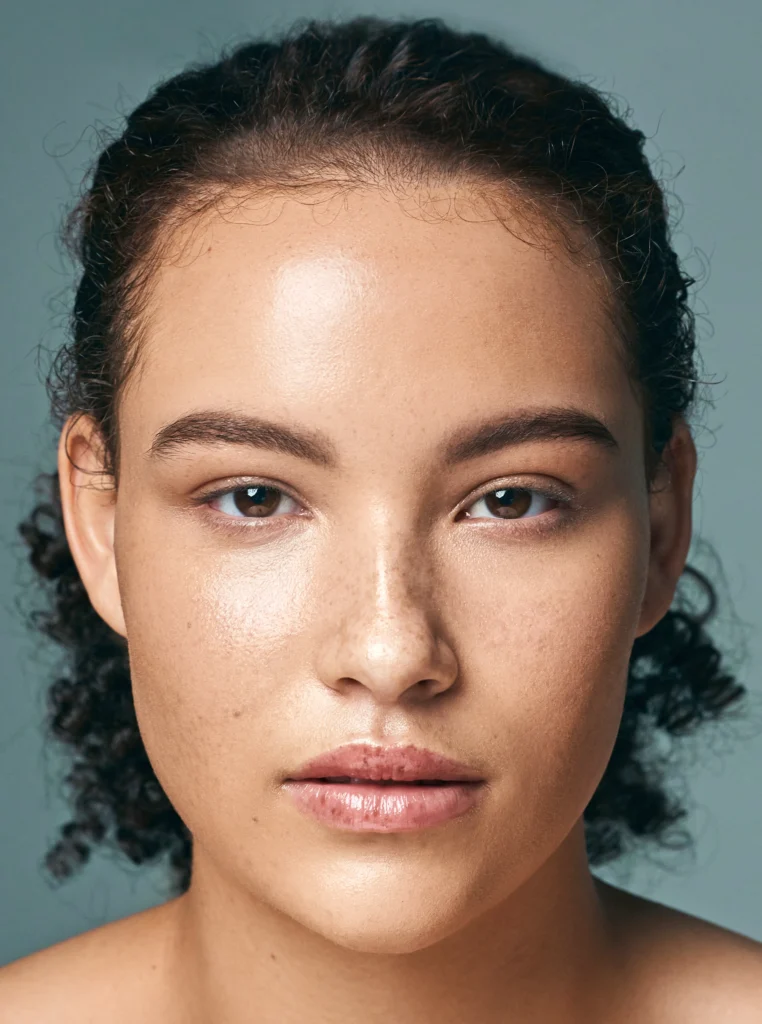 fox eye canthoplasty