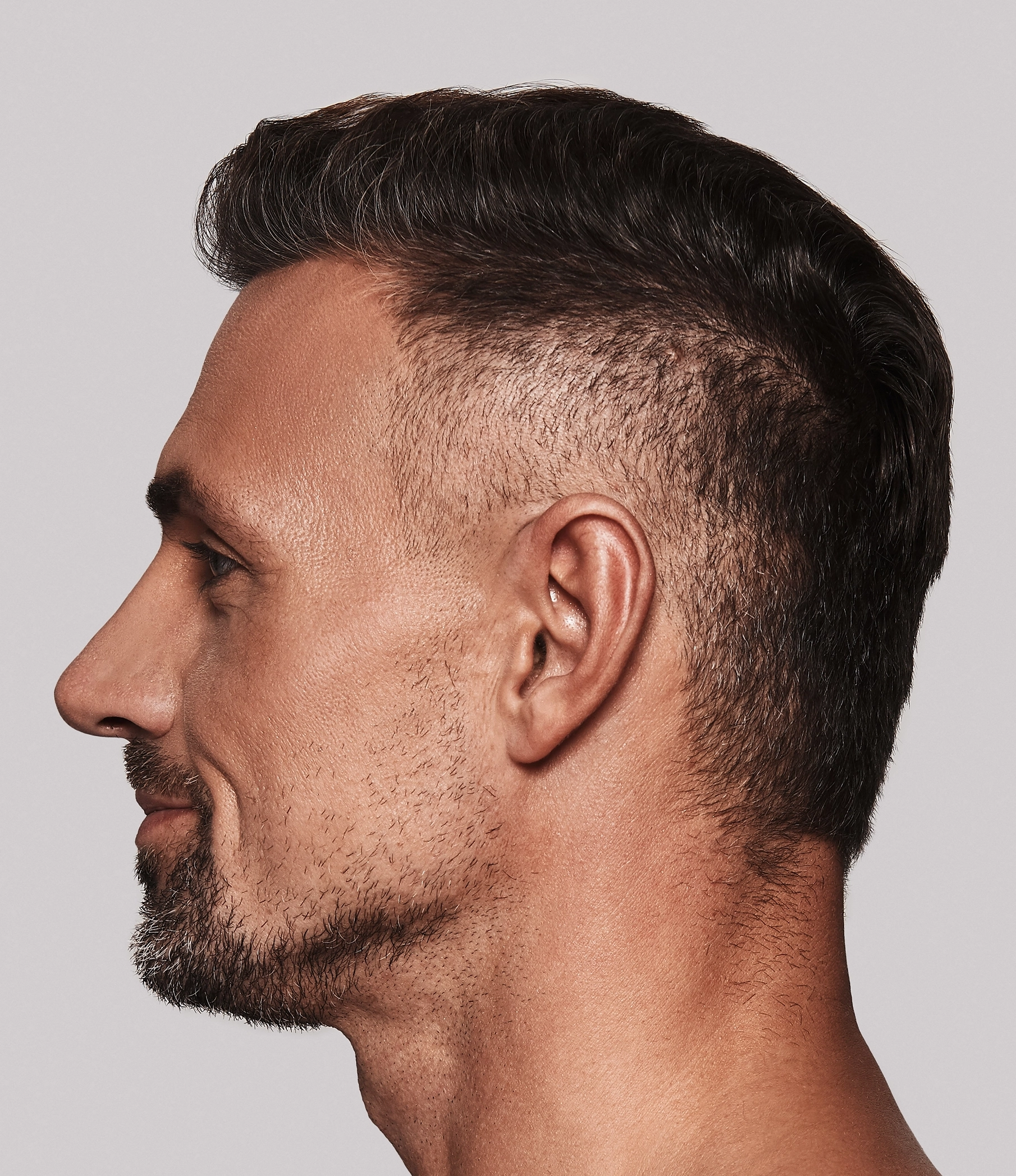male rhinoplasty