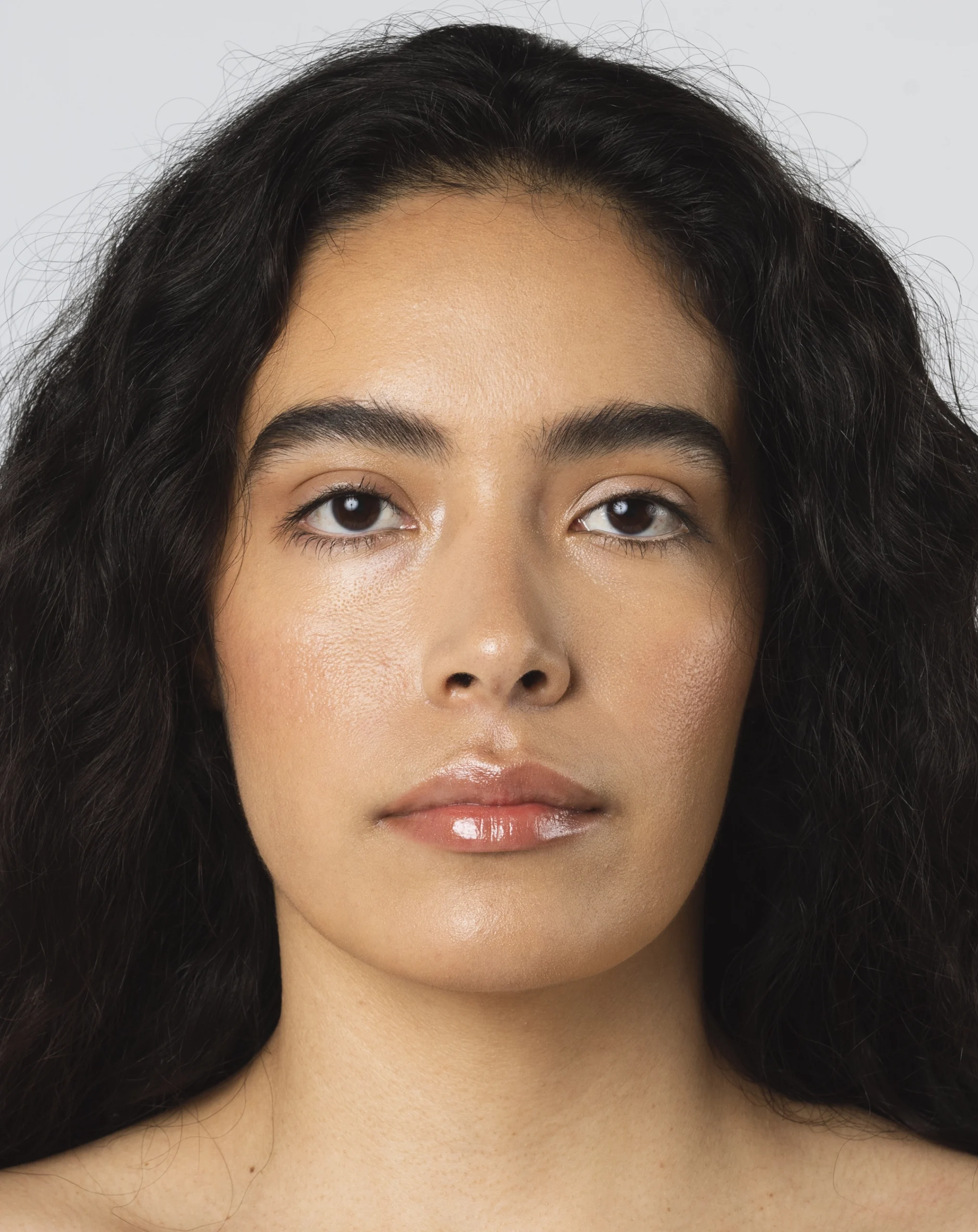 facial feminization surgery