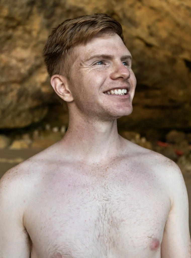 masculinizing top surgery