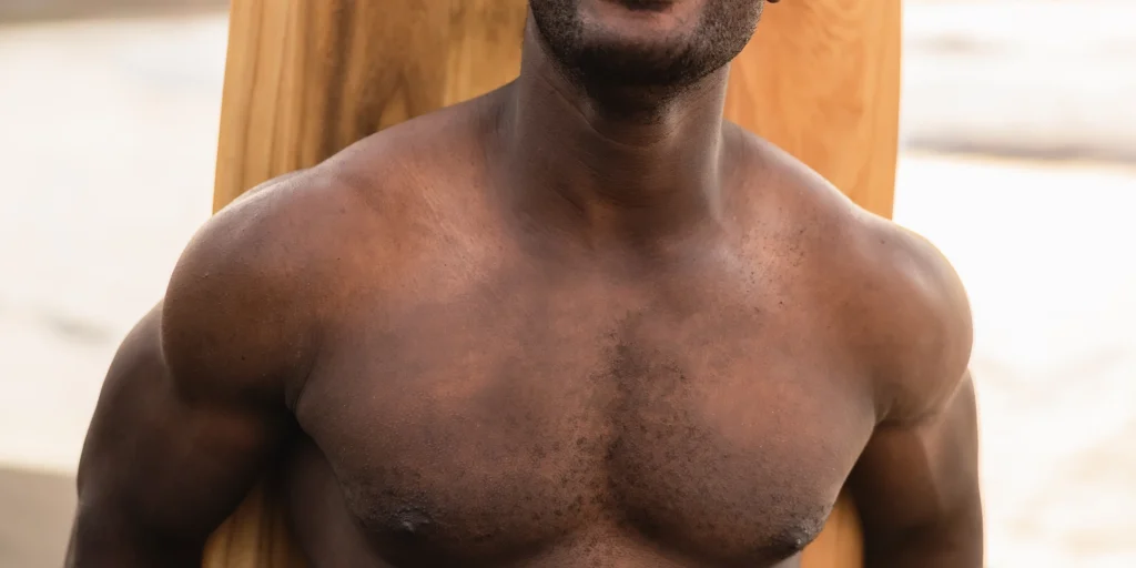 gynecomastia surgery