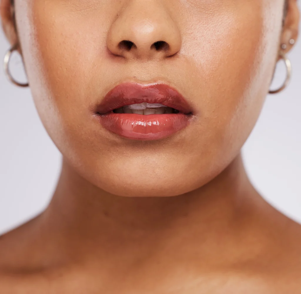 chin reduction preop