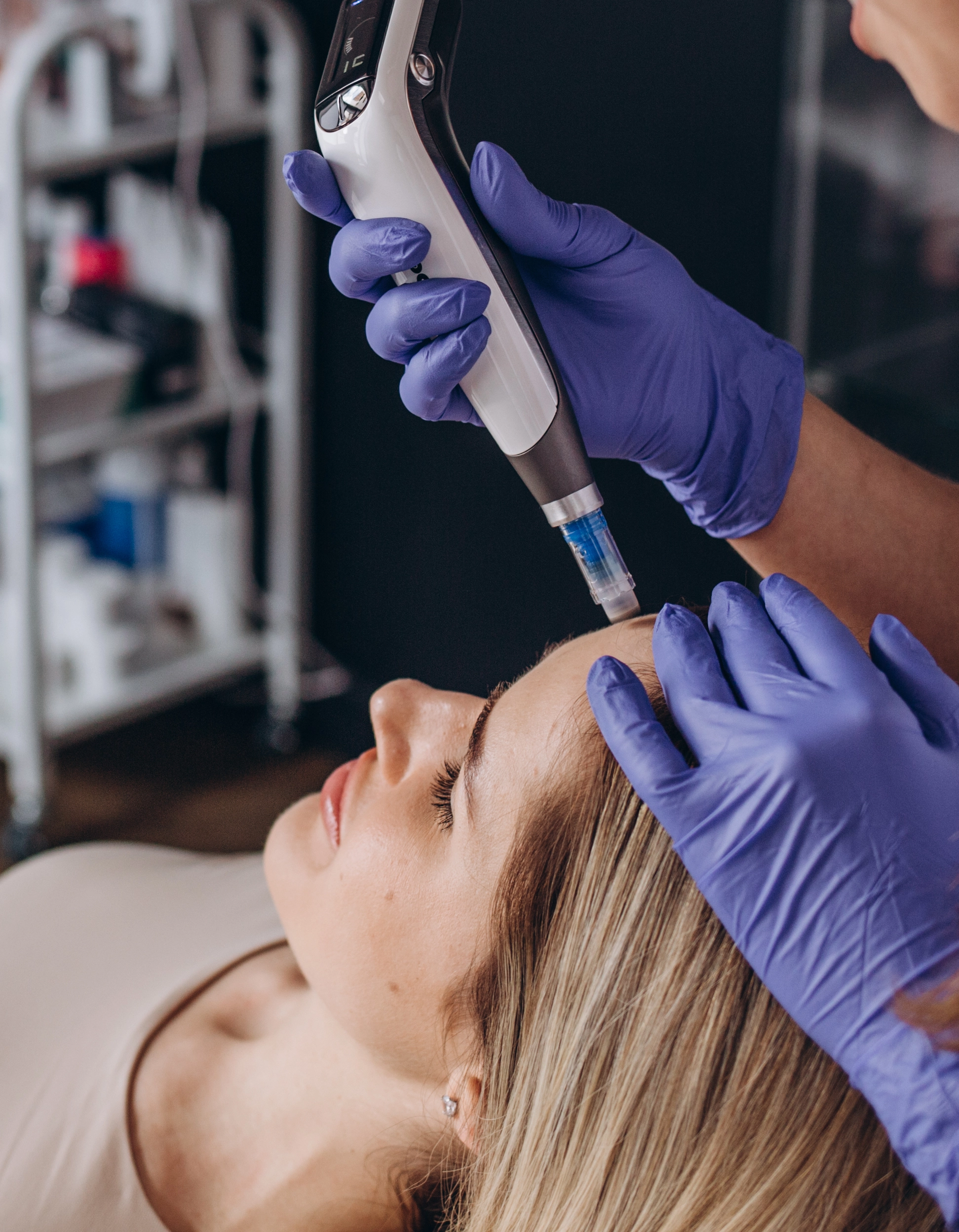 microneedling dermapen