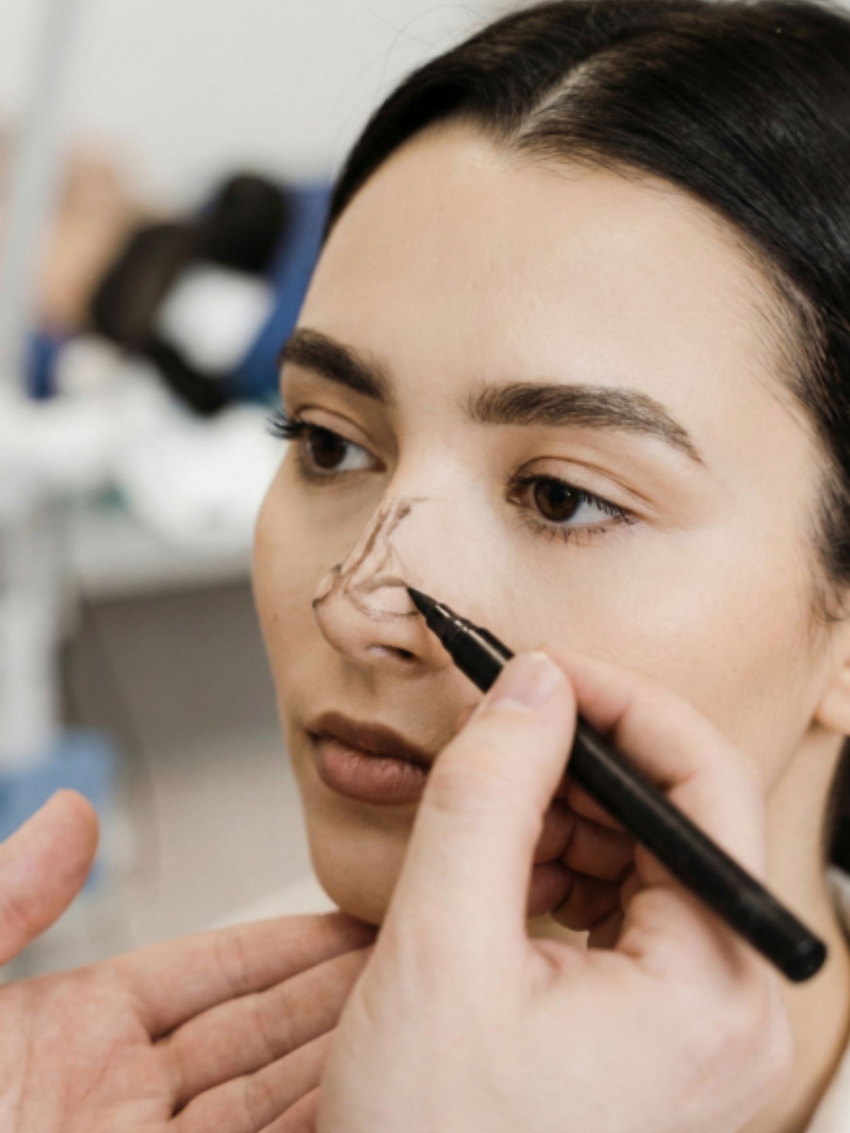 Asian rhinoplasty consultation with precise nasal contour markings before surgery