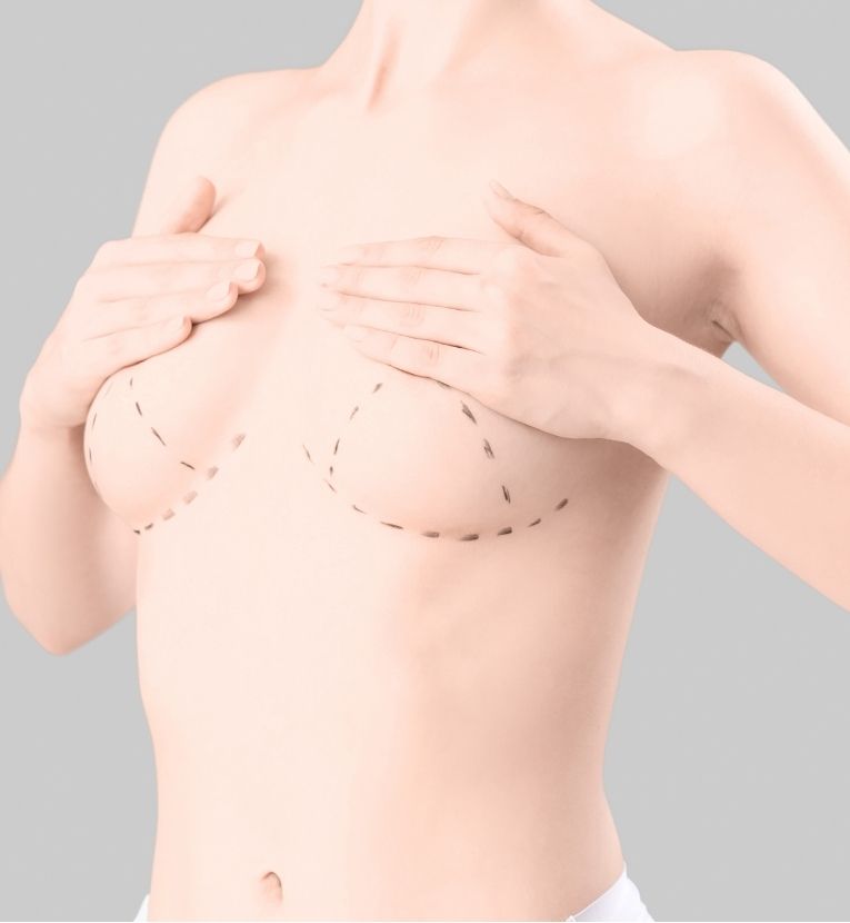 Woman during breast augmentation planning highlighting balanced and natural proportions at Aestira Plastic Surgery in Miami.