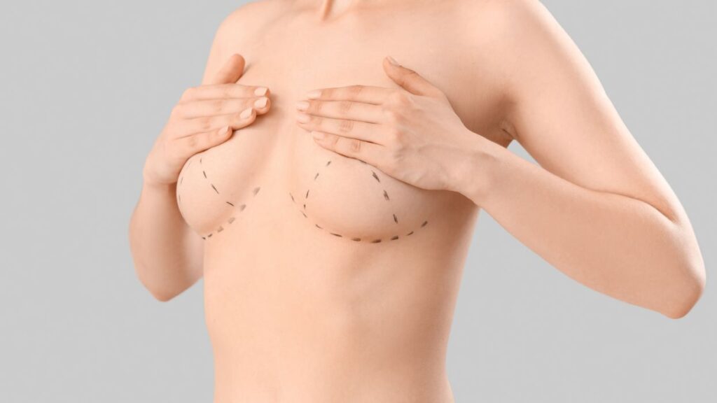 What Is the Internal Bra in Breast Surgery | Aestira